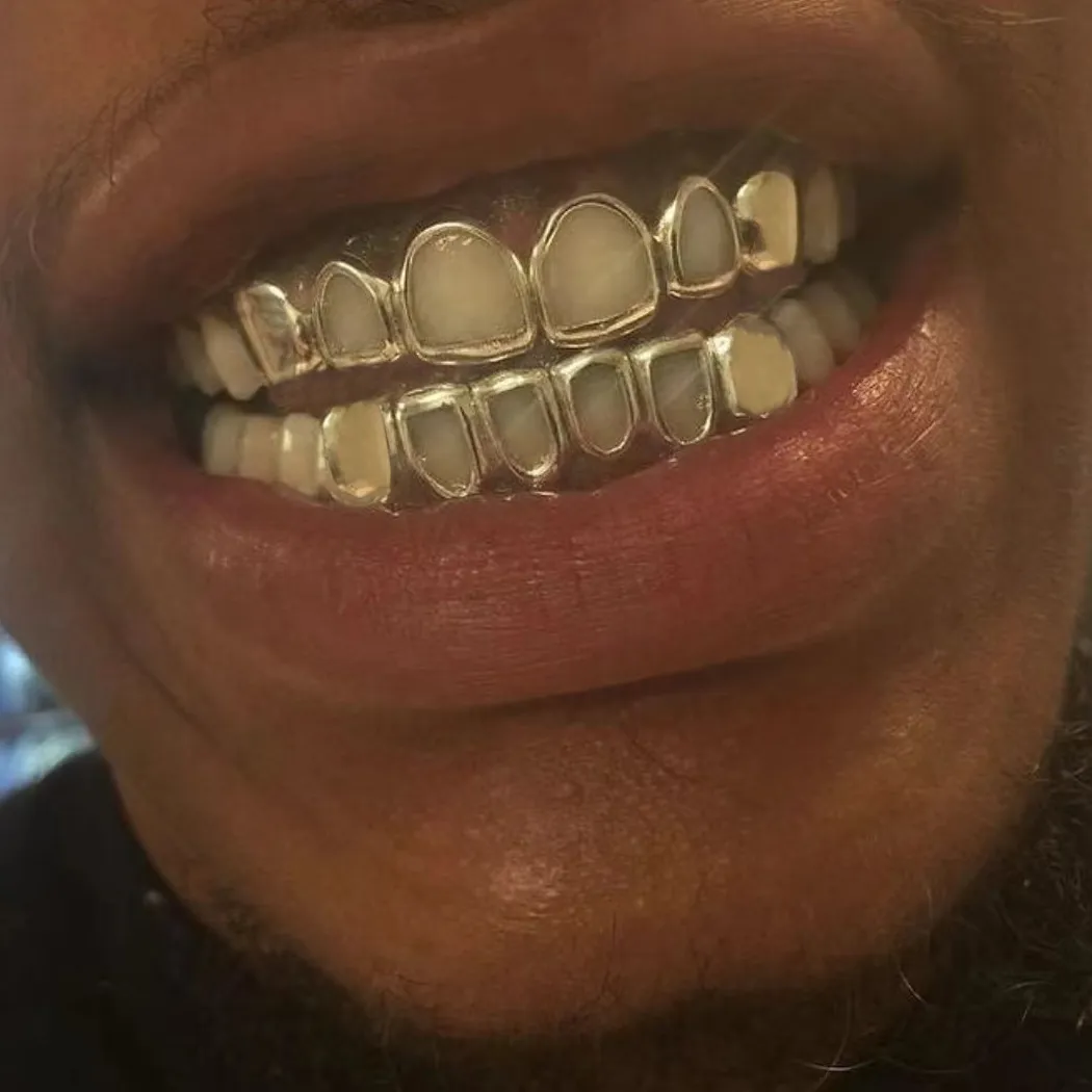Authentic The Obsidian Sovereign Grillz- A Gold- Plated Talisman Of Vocal Power And Audacious Presence