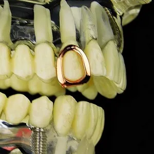 Authentic Open Face 14k Rose Gold Plated Grillz Single Hollow Cap One Top Tooth Grills