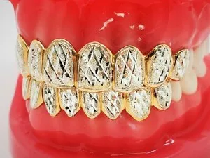 Authentic Dazzling Armor for the Soul: 18K Yellow Gold Plated Grillz
