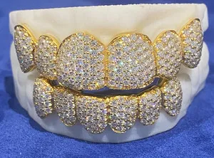 Authentic Radiant Illumination: Moissanite Grillz for Inner Brilliance